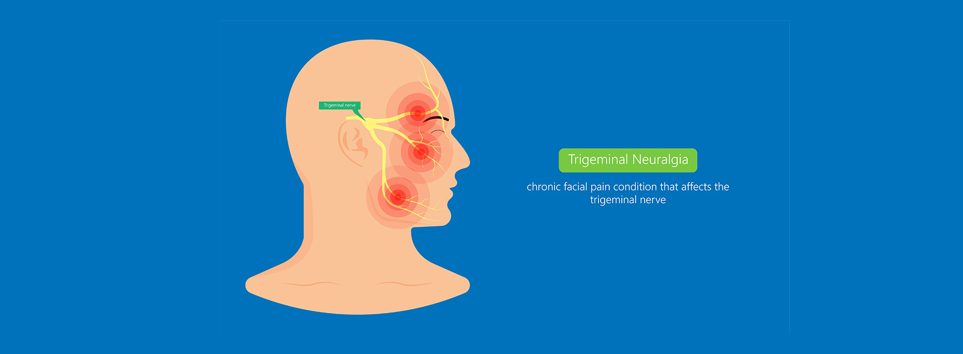 Nevada Orofacial Pain, TMJ   Sleep Clinic | Headache Disorders Diagnosis and Treatment, Chronic Facial Pain and Sleep Apnea